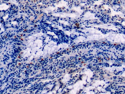 DAB staining on IHC-P; Sample: Human Pancreas Tissue; Primary Ab: 10ug/ml Mouse Anti-Rat ANXA1 Antibody; Second Ab: 2ug/mL HRP-Linked Caprine Anti-Mouse IgG Polyclonal Antibody