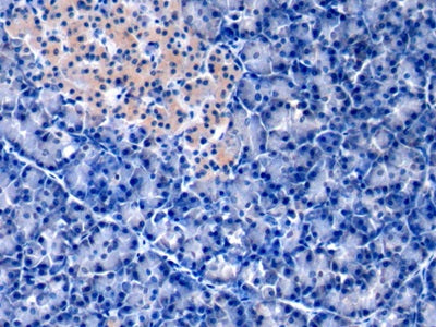 Western Blot; Sample: Lane1: Human Lung lysate; Lane2: K562 cell lysate; Lane3: Hela cell lysate; Lane4: HepG2 cell lysate; Primary Ab: 3ug/ml Mouse Anti-Rat ANXA1 Antibody Second Ab: 0.2ug/mL HRP-Linked Caprine Anti-Mouse IgG Polyclonal Antibody