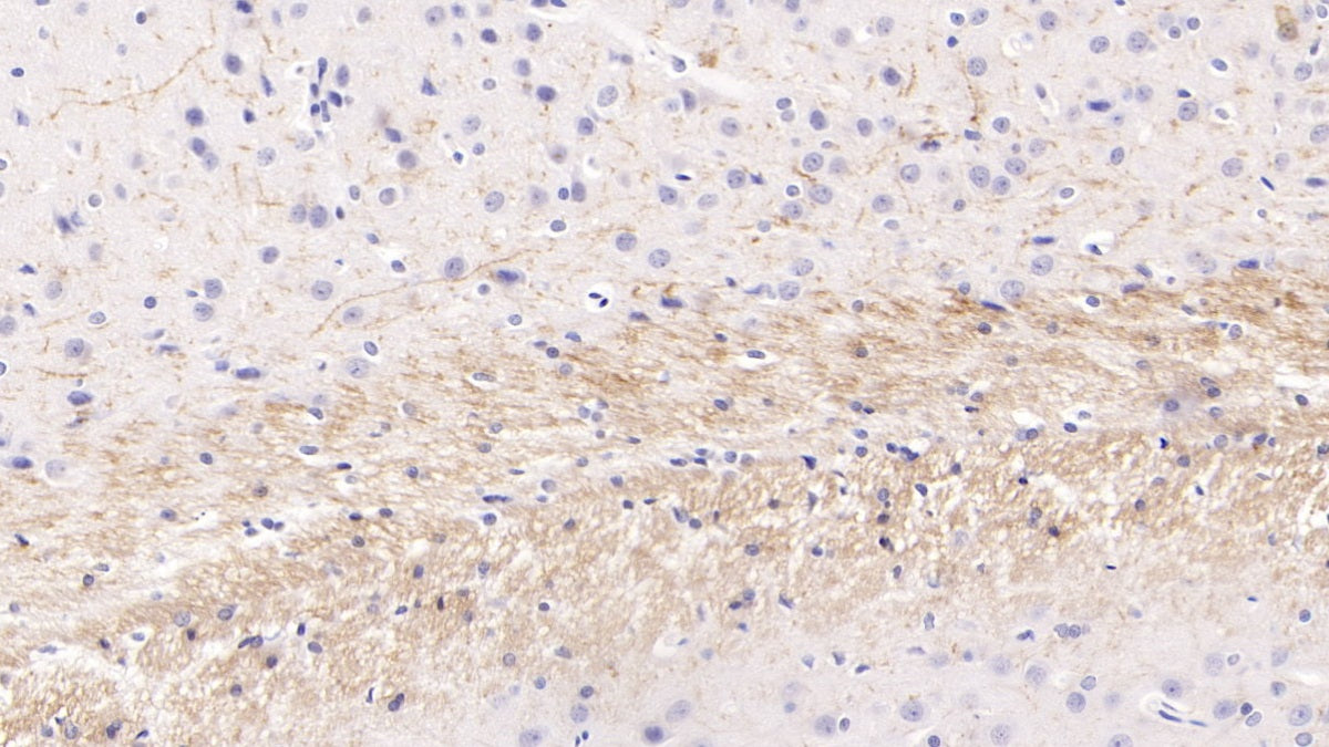 DAB staining on IHC-P; Sample: Rat Spinal cord Tissue; Primary Ab: 10ug/ml Mouse Anti-Rat PTHrP Antibody; Second Ab: 2ug/mL HRP-Linked Caprine Anti-Mouse IgG Polyclonal Antibody