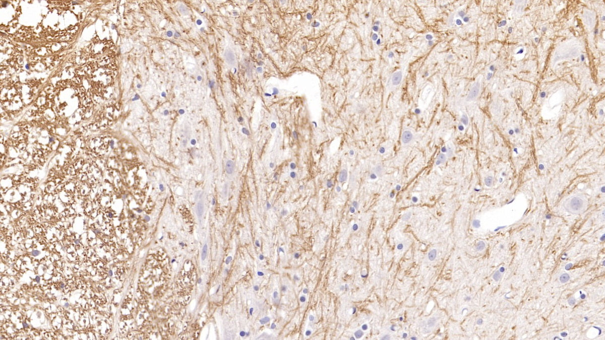 Western Blot; Sample: A549 cell lysate; Primary Ab: 2ug/ml Mouse Anti-Rat PTHrP Antibody Second Ab: 0.2ug/mL HRP-Linked Caprine Anti-Mouse IgG Polyclonal Antibody