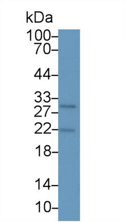 Parathyroid Hormone Related Protein (PTHrP) Monoclonal Antibody - image 4