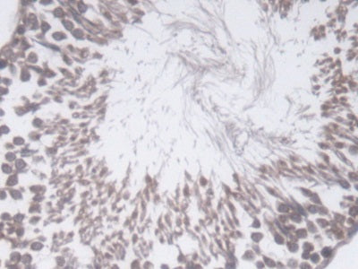DAB staining on IHC-P; Samples: Rat Kidney Tissue; Primary Ab: 20ug/ml Mouse Anti-Rat TGFb1 Antibody; Second Ab: 2ug/mL HRP-Linked Caprine Anti-Mouse IgG Polyclonal Antibody