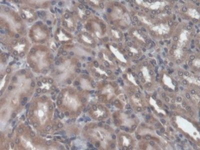 DAB staining on IHC-P; Samples: Rat Skin Tissue; Primary Ab: 20ug/ml Mouse Anti-Rat TGFb1 Antibody; Second Ab: 2ug/mL HRP-Linked Caprine Anti-Mouse IgG Polyclonal Antibody