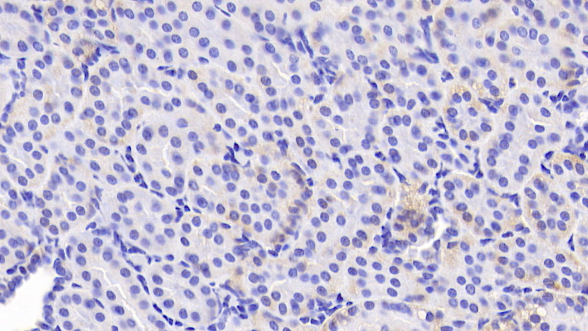 DAB staining on IHC-P; Sample: Human Cardiac Muscle Tissue; Primary Ab: 20ug/ml Mouse Anti-Human ADP Antibody; Second Ab: 2ug/mL HRP-Linked Caprine Anti-Mouse IgG Polyclonal Antibody