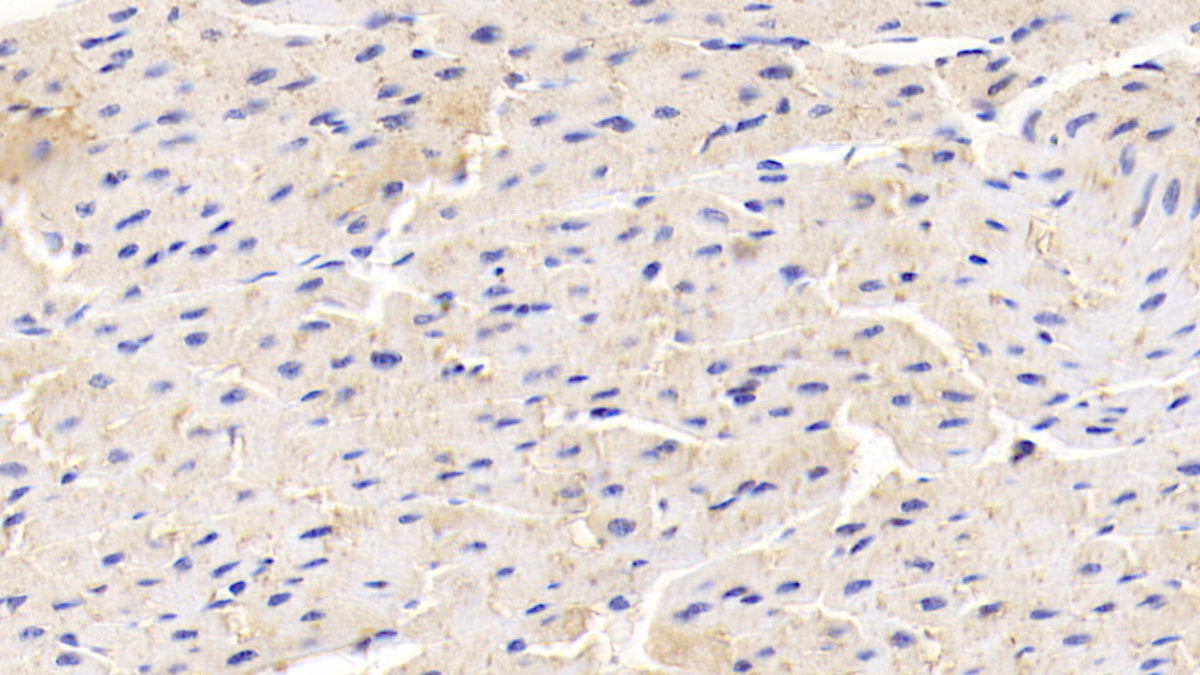 DAB staining on IHC-P; Sample: Human Colon Tissue; Primary Ab: 20ug/ml Mouse Anti-Human ADP Antibody; Second Ab: 2ug/mL HRP-Linked Caprine Anti-Mouse IgG Polyclonal Antibody