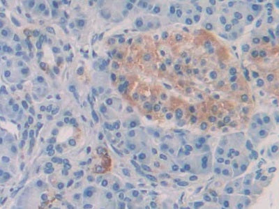 Anterior Gradient 2 (AGR2) Monoclonal Antibody - image 5