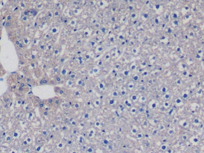 DAB staining on IHC-P; Sample: Rat Ovary Tissue; Primary Ab: 10ug/ml Mouse Anti-Rat TGFb1 Antibody; Second Ab: 2ug/mL HRP-Linked Caprine Anti-Mouse IgG Polyclonal Antibody