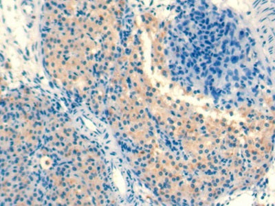 Transforming Growth Factor Beta 1 (TGFb1) Monoclonal Antibody - image 3