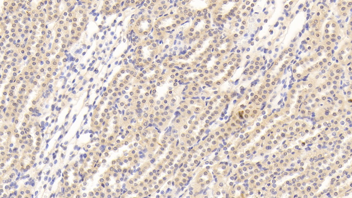 DAB staining on IHC-P; Sample: Rat Ovary Tissue; Primary Ab: 30ug/ml Mouse Anti-Rat TGFb1 Antibody; Second Ab: 2ug/mL HRP-Linked Caprine Anti-Mouse IgG Polyclonal Antibody