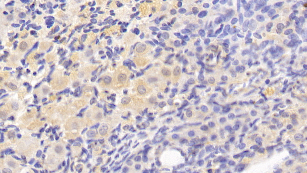 DAB staining on IHC-P; Sample: Rat Liver Tissue; Primary Ab: 30ug/ml Mouse Anti-Rat TGFb1 Antibody; Second Ab: 2ug/mL HRP-Linked Caprine Anti-Mouse IgG Polyclonal Antibody
