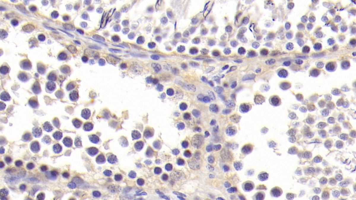 Transforming Growth Factor Beta 1 (TGFb1) Monoclonal Antibody - image 5