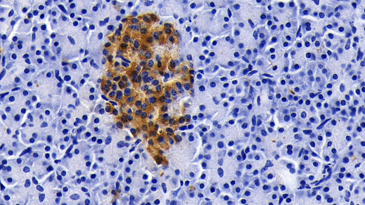 DAB staining on IHC-P; Sample: Porcine Pancreas Tissue; Primary Ab: 20ug/ml Mouse Anti-Porcine CLU Antibody; Control: Used PBS instead of primary antibody; Second Ab: 2ug/ml HRP-Linked Caprine Anti-Mouse IgG Polyclonal Antibody