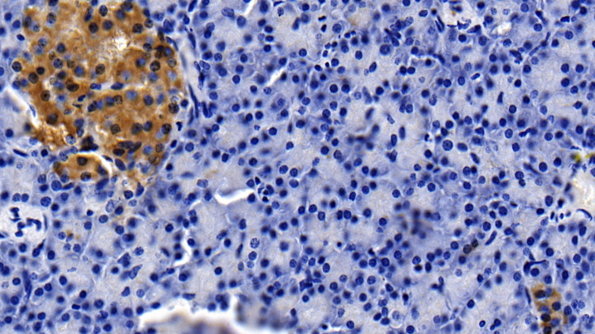 DAB staining on IHC-P; Sample: Porcine Liver Tissue; Primary Ab: 20ug/ml Mouse Anti-Porcine CLU Antibody; Second Ab: 2ug/mL HRP-Linked Caprine Anti-Mouse IgG Polyclonal Antibody