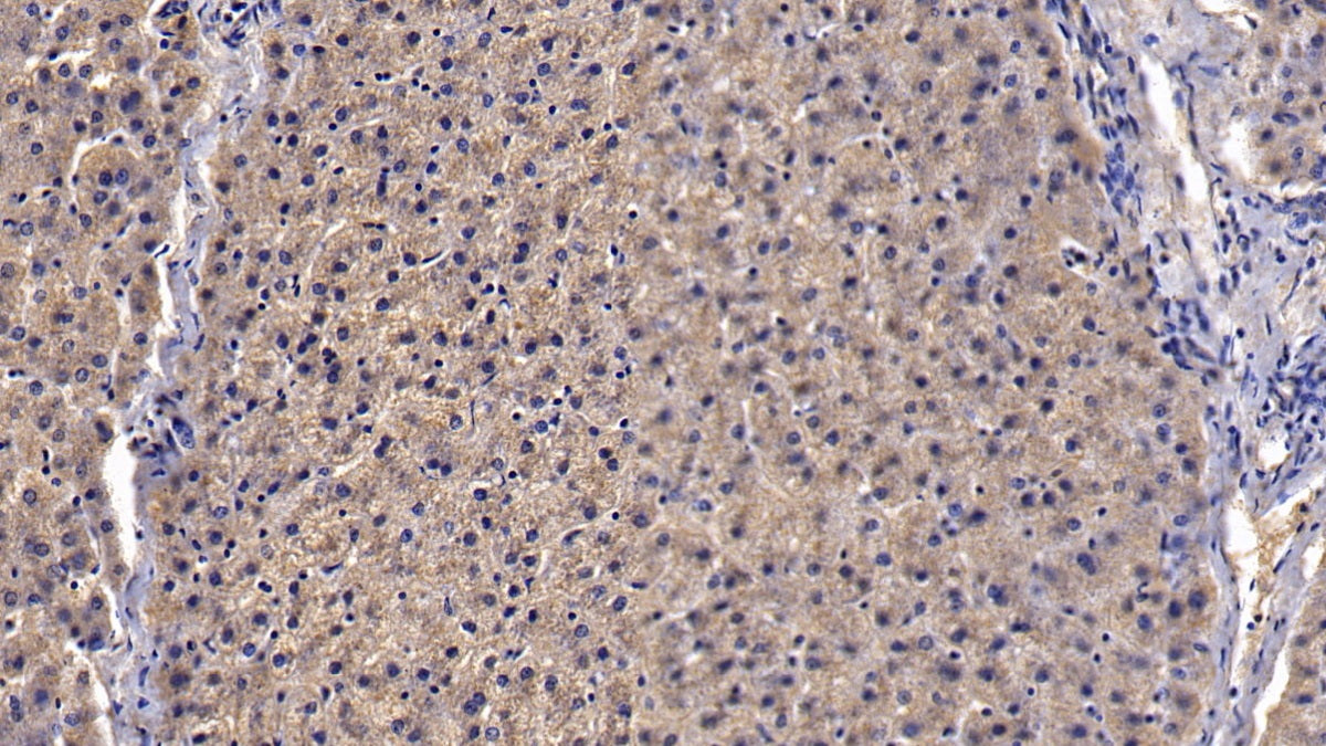 Western Blot; Sample: Lane1: Porcine Serum; Lane2: Porcine Lung lysate; Lane3: Porcine Cerebrum lysate Primary Ab: 2ug/ml Mouse Anti-Porcine CLU Antibody Second Ab: 0.2ug/mL HRP-Linked Caprine Anti-Mouse IgG Polyclonal Antibody