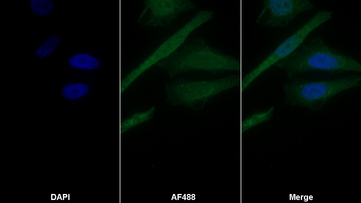 Western Blot; Sample: Human Serum Primary Ab: 2ug/ml Mouse Anti-Human a1BG Antibody Second Ab: 0.2ug/mL HRP-Linked Rabbit Anti-Mouse IgG Polyclonal Antibody
