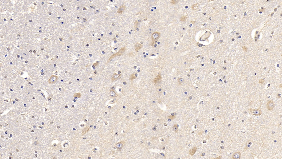 Western Blot; Sample: Porcine Cerebrum lysate; Primary Ab: 2ug/ml Mouse Anti-Human FGF13 Antibody Second Ab: 0.2ug/mL HRP-Linked Caprine Anti-Mouse IgG Polyclonal Antibody