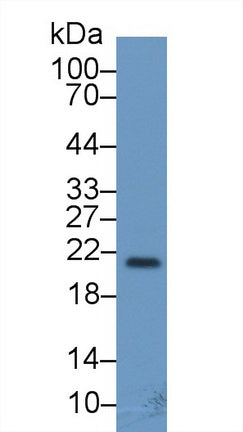 Western Blot; Sample: Rat Cerebrum lysate; Primary Ab: 2ug/ml Mouse Anti-Human FGF13 Antibody; Second Ab: 0.2ug/mL HRP-Linked Caprine Anti-Mouse IgG Polyclonal Antibody