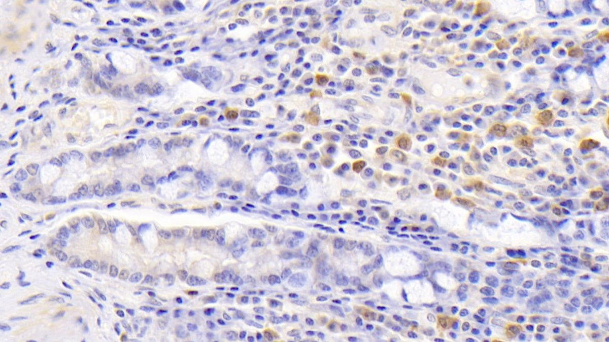DAB staining on IHC-P; Sample: Human Kidney Tissue; Primary Ab: 30ug/ml Mouse Anti-Human ALOX15 Antibody; Second Ab: 2ug/mL HRP-Linked Caprine Anti-Mouse IgG Polyclonal Antibody