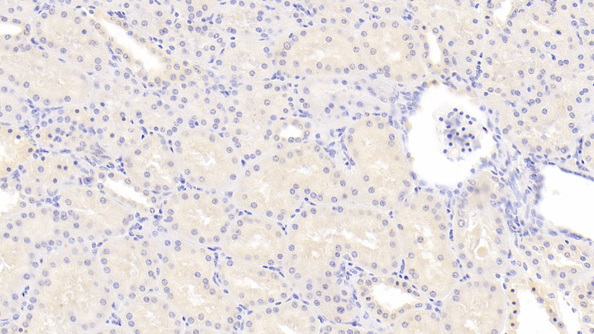 Arachidonate-15-Lipoxygenase (ALOX15) Monoclonal Antibody - image 3