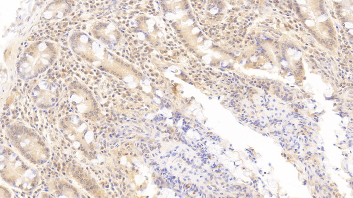 DAB staining on IHC-P; Sample: Human Liver Tissue; Primary Ab: 30ug/ml Mouse Anti-Human OAS1 Antibody; Second Ab: 2ug/mL HRP-Linked Caprine Anti-Mouse IgG Polyclonal Antibody