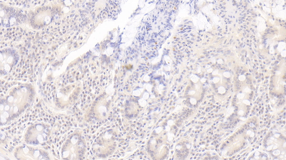 2',5'-Oligoadenylate Synthetase 1 (OAS1) Monoclonal Antibody - image 2