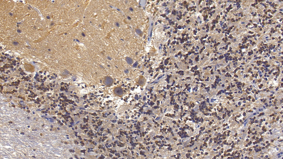 DAB staining on IHC-P; Sample: Human Cardiac Muscle Tissue; Primary Ab: 10ug/ml Mouse Anti-Human SEMA5B Antibody; Second Ab: 2ug/mL HRP-Linked Caprine Anti-Mouse IgG Polyclonal Antibody