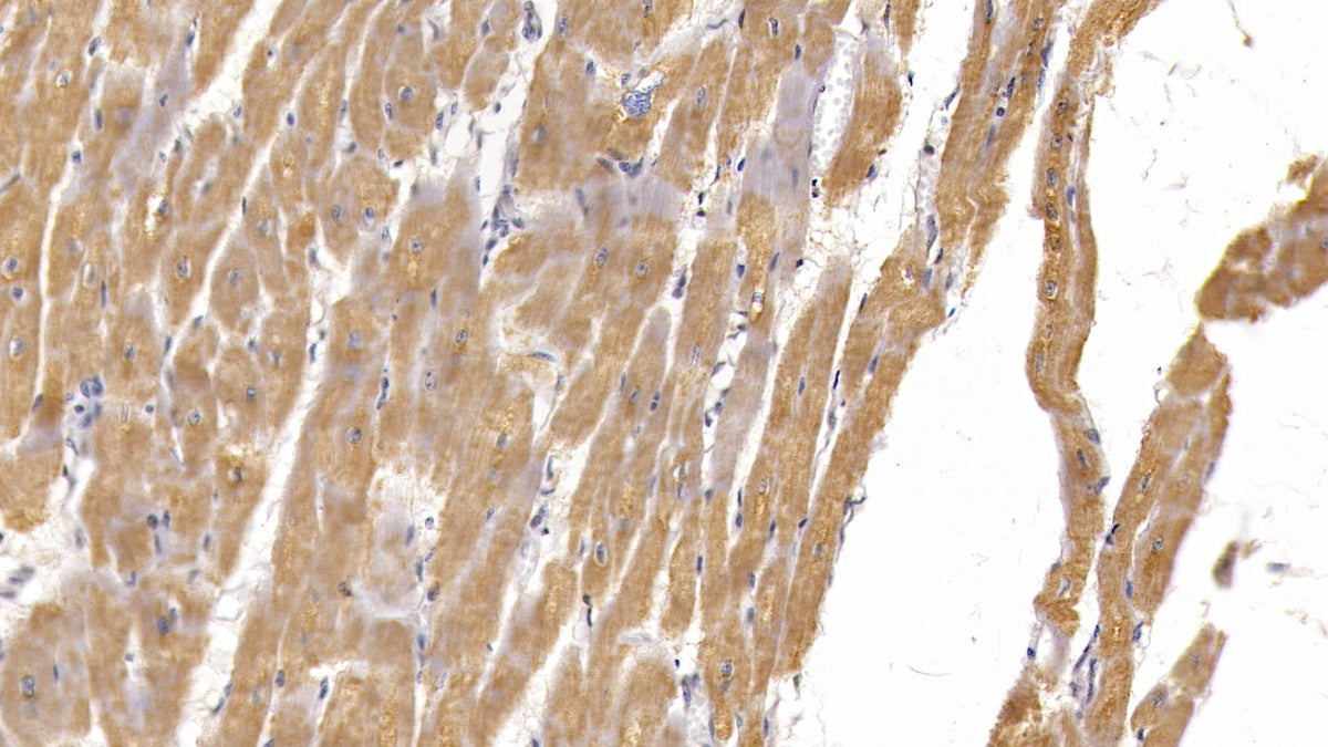 Semaphorin 5B (SEMA5B) Monoclonal Antibody - image 3