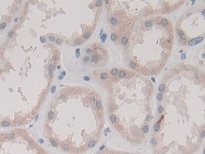 DAB staining on IHC-P; Sample: Human Pancreas Tissue; Primary Ab: 30ug/ml Mouse Anti-Human TMEM27 Antibody; Second Ab: 2ug/mL HRP-Linked Caprine Anti-Mouse IgG Polyclonal Antibody
