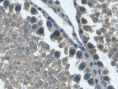 Androgen Receptor (AR) Monoclonal Antibody - image 2