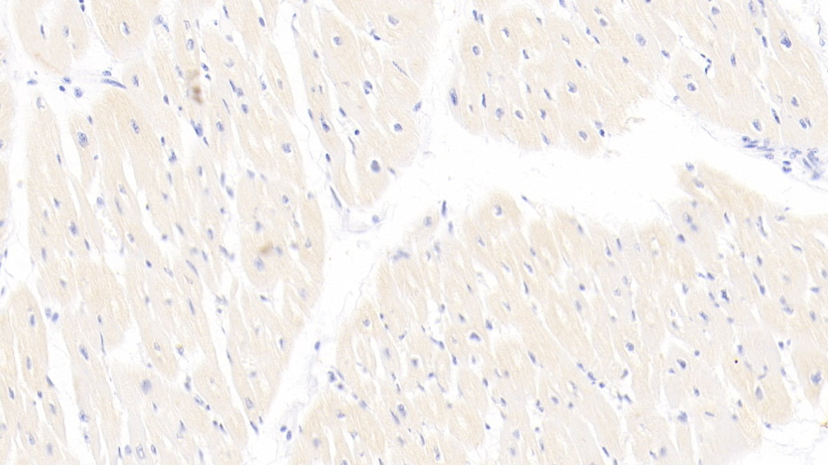 DAB staining on IHC-P; Sample: Porcine Cardiac Muscle Tissue; Primary Ab: 10ug/ml Mouse Anti-Human TNNT2 Antibody; Control: Used PBS instead of primary antibody; Second Ab: 2ug/ml HRP-Linked Caprine Anti-Mouse IgG Polyclonal Antibody