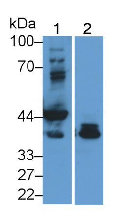 Troponin T Type 2, Cardiac (TNNT2) Monoclonal Antibody - image 4