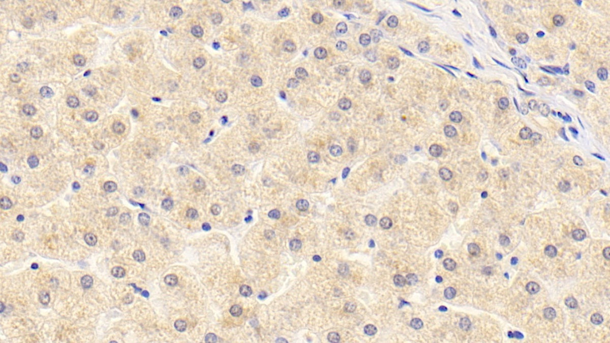 DAB staining on IHC-P; Sample: Human Kidney Tissue; Primary Ab: 20ug/ml Mouse Anti-Human a2PI Antibody; Second Ab: 2ug/mL HRP-Linked Caprine Anti-Mouse IgG Polyclonal Antibody