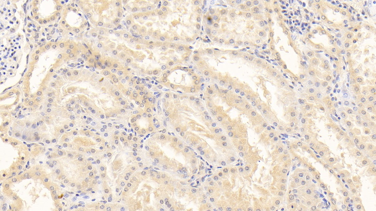 DAB staining on IHC-P; Sample: Human Liver Tissue; Primary Ab: 20ug/ml Mouse Anti-Human a2PI Antibody; Control: Used PBS instead of primary antibody; Second Ab: 2ug/ml HRP-Linked Caprine Anti-Mouse IgG Polyclonal Antibody