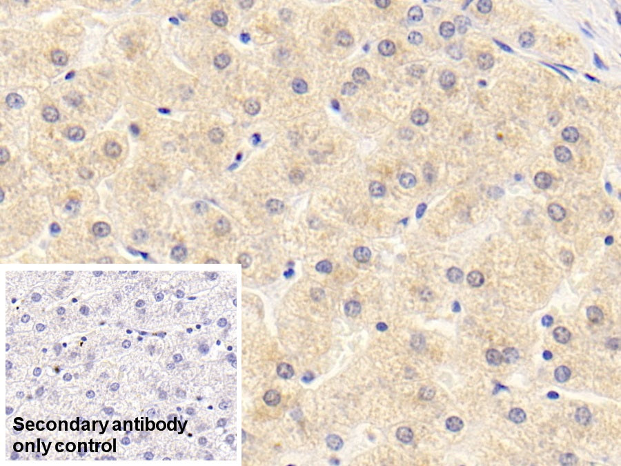 DAB staining on IHC-P; Sample: Human Kidney Tissue; Primary Ab: 20ug/ml Mouse Anti-Human a2PI Antibody; Control: Used PBS instead of primary antibody; Second Ab: 2ug/ml HRP-Linked Caprine Anti-Mouse IgG Polyclonal Antibody
