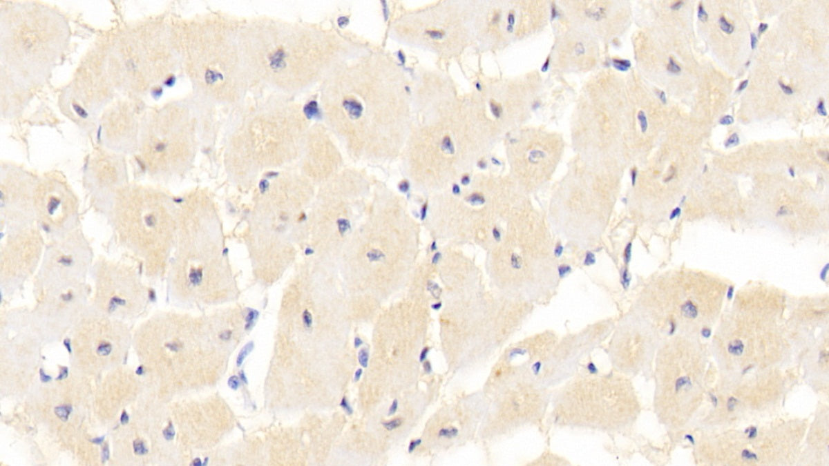 DAB staining on IHC-P; Sample: Human Kidney Tissue; Primary Ab: 20ug/ml Mouse Anti-Human HBEGF Antibody; Second Ab: 2ug/mL HRP-Linked Caprine Anti-Mouse IgG Polyclonal Antibody