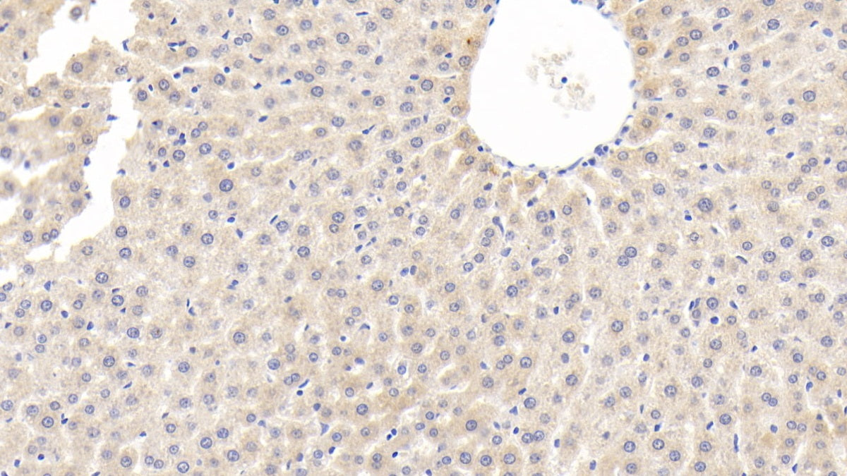 DAB staining on IHC-P; Sample: Rat Cardiac Muscle Tissue; Primary Ab: 30ug/ml Mouse Anti-Rat ADP Antibody; Second Ab: 2ug/mL HRP-Linked Caprine Anti-Mouse IgG Polyclonal Antibody