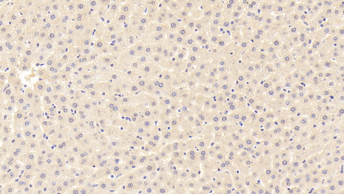 DAB staining on IHC-P; Sample: Rat Cardiac Muscle Tissue; Primary Ab: 30ug/ml Mouse Anti-Rat ADP Antibody; Second Ab: 2ug/mL HRP-Linked Caprine Anti-Mouse IgG Polyclonal Antibody