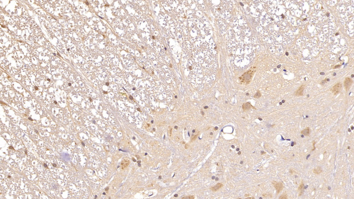 Adiponectin (ADPN) Monoclonal Antibody - image 2