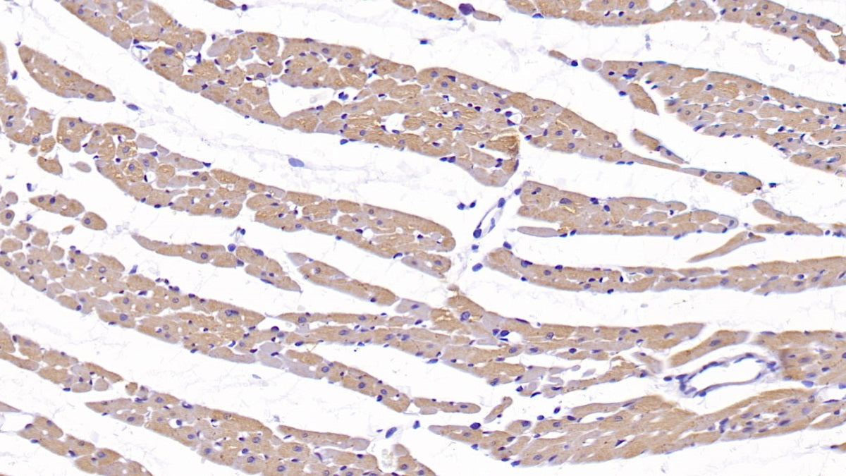 DAB staining on IHC-P; Sample: Rat Kidney Tissue; Primary Ab: 40ug/ml Mouse Anti-Rat IL18 Antibody; Second Ab: 2ug/mL HRP-Linked Caprine Anti-Mouse IgG Polyclonal Antibody