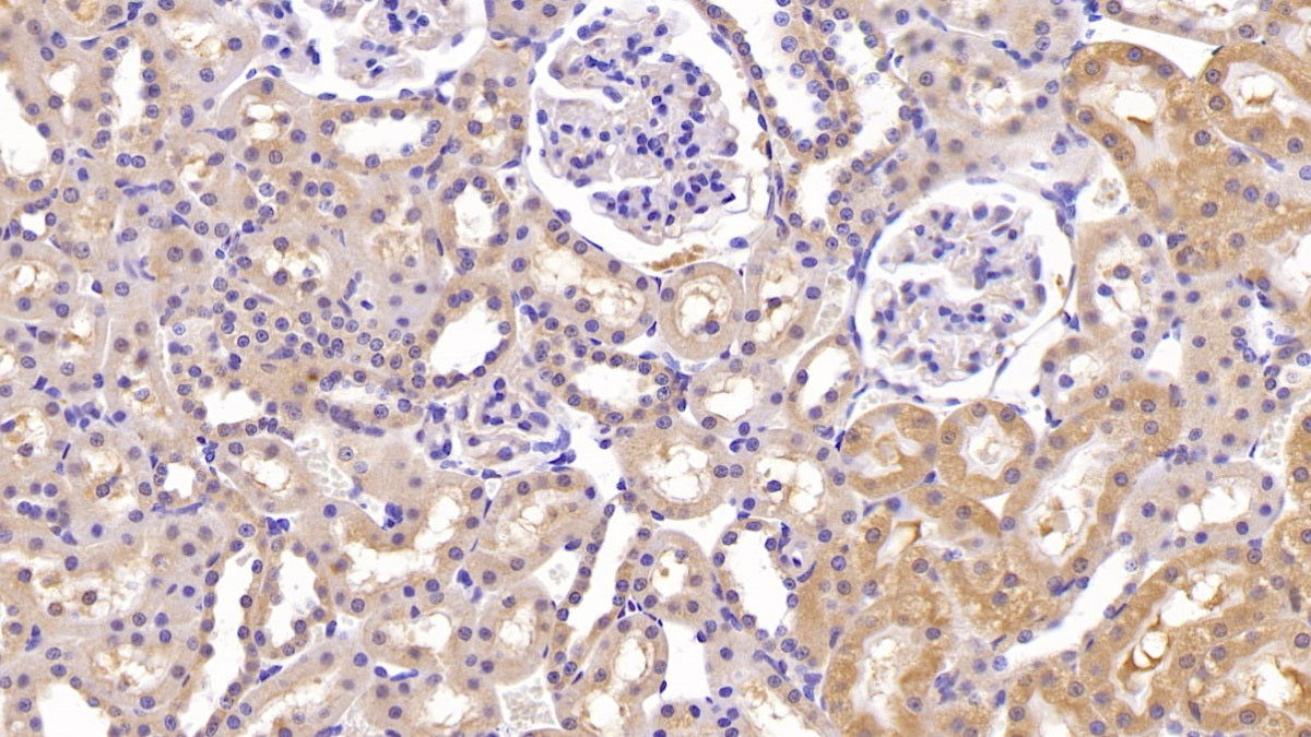 Interleukin 18 (IL18) Monoclonal Antibody - image 3