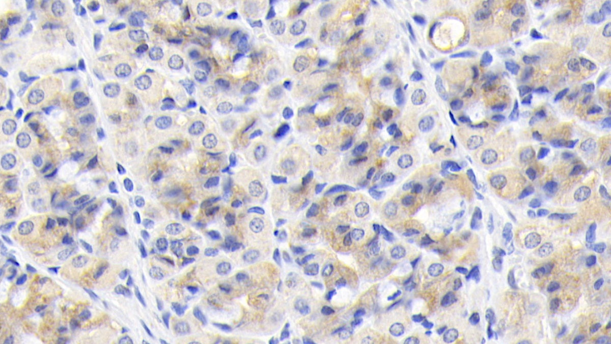 DAB staining on IHC-P; Sample: Human Pancreas Tissue; Primary Ab: 20ug/ml Mouse Anti-Human TNC Antibody; Second Ab: 2ug/mL HRP-Linked Caprine Anti-Mouse IgG Polyclonal Antibody