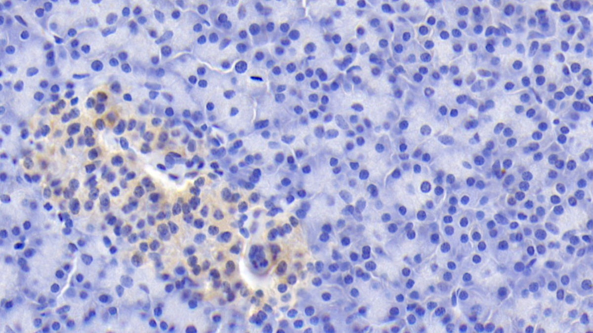 Tenascin C (TNC) Monoclonal Antibody - image 3