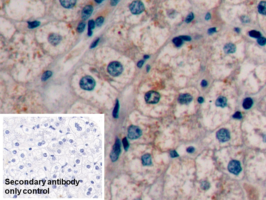 Alpha-Fetoprotein (AFP) Monoclonal Antibody - image 5