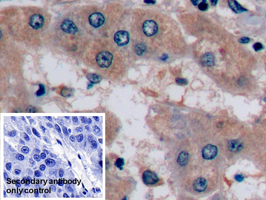 Alpha-Fetoprotein (AFP) Monoclonal Antibody - image 5