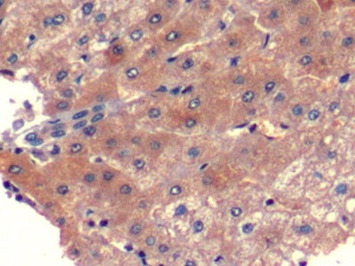 DAB staining on IHC-P; Sample: Human Stomach Tissue; Primary Ab: 10ug/ml Mouse Anti-Human aFP Antibody; Second Ab: 2ug/mL HRP-Linked Caprine Anti-Mouse IgG Polyclonal Antibody