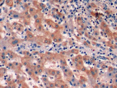 Western Blot; Sample: Lane1: Human Liver lysate; Lane2: Human Lung lysate Primary Ab: 3ug/ml Mouse Anti-Human aFP Antibody Second Ab: 0.2ug/mL HRP-Linked Caprine Anti-Mouse IgG Polyclonal Antibody