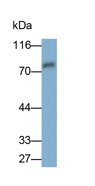 Alpha-Fetoprotein (AFP) Monoclonal Antibody - image 5