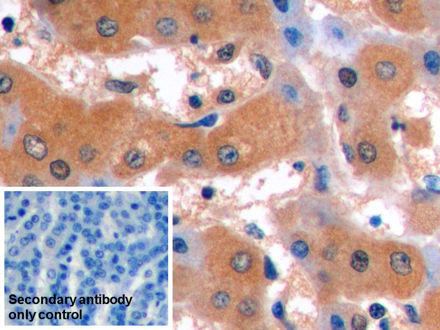 Alpha-Fetoprotein (AFP) Monoclonal Antibody - image 5