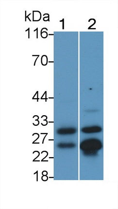 Cathepsin B (CTSB) Monoclonal Antibody - image 2