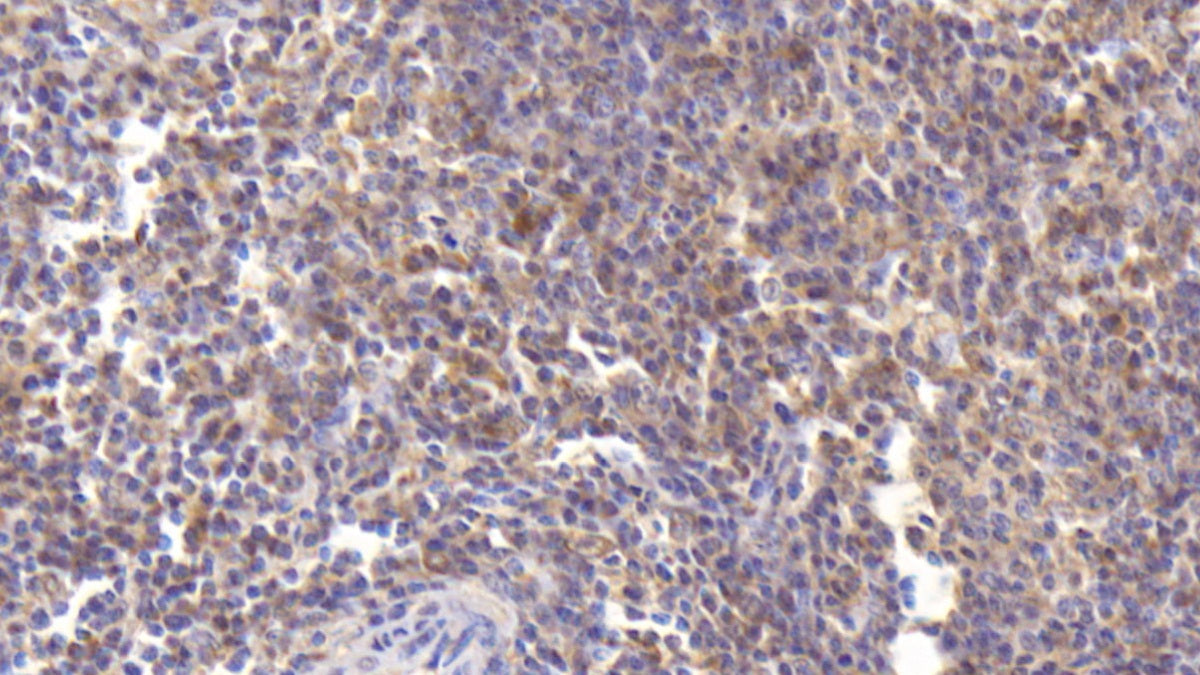 Azurocidin (AZU) Monoclonal Antibody – Vareum